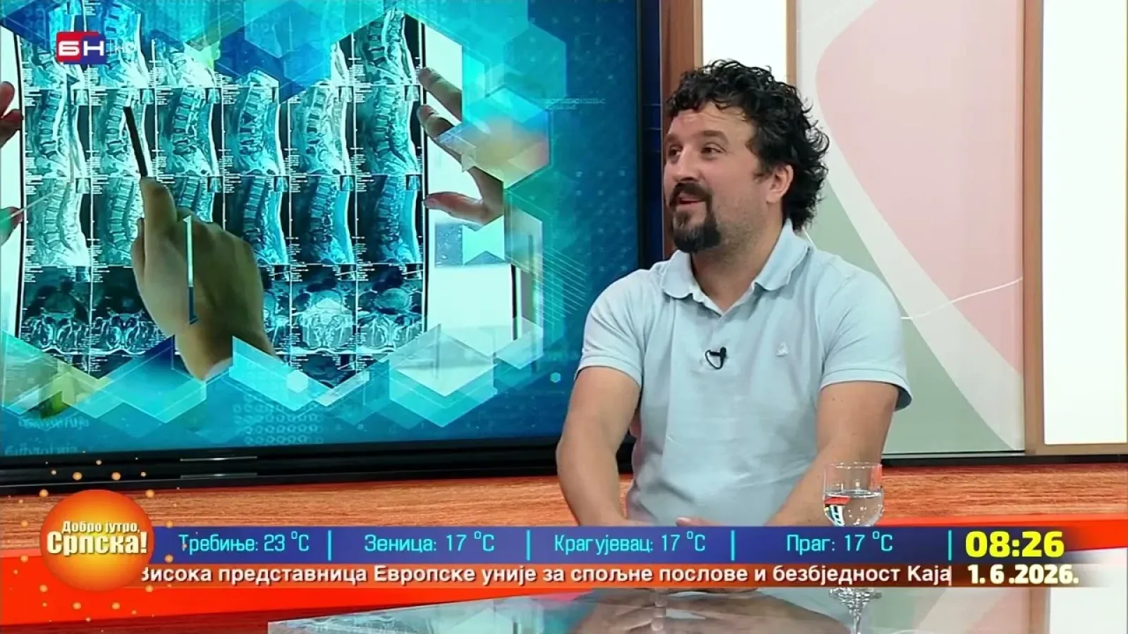 Остеопороза || др Александар Ивановић - ЈУТАРЊА КЛИНИКА